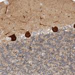 BAIAP2 Antibody in Immunohistochemistry (Paraffin) (IHC (P))