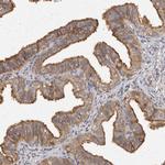 BAIAP2 Antibody in Immunohistochemistry (Paraffin) (IHC (P))