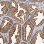 BAIAP2 Antibody in Immunohistochemistry (Paraffin) (IHC (P))