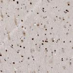 ZEB1 Antibody in Immunohistochemistry (Paraffin) (IHC (P))