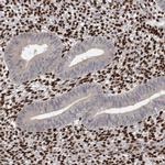 ZEB1 Antibody in Immunohistochemistry (Paraffin) (IHC (P))