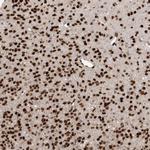 ZEB1 Antibody in Immunohistochemistry (Paraffin) (IHC (P))