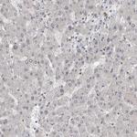 ZEB1 Antibody in Immunohistochemistry (Paraffin) (IHC (P))