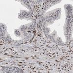 ZEB1 Antibody in Immunohistochemistry (Paraffin) (IHC (P))