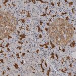 Annexin A11 Antibody in Immunohistochemistry (Paraffin) (IHC (P))