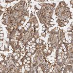 Annexin A11 Antibody in Immunohistochemistry (Paraffin) (IHC (P))