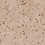 ZMAT3 Antibody in Immunohistochemistry (Paraffin) (IHC (P))