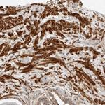 MEK5 Antibody in Immunohistochemistry (Paraffin) (IHC (P))