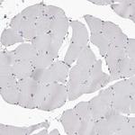 c-Cbl Antibody in Immunohistochemistry (Paraffin) (IHC (P))