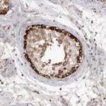 c-Cbl Antibody in Immunohistochemistry (Paraffin) (IHC (P))