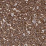 c-Cbl Antibody in Immunohistochemistry (Paraffin) (IHC (P))