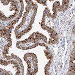 ATPIF1 Antibody in Immunohistochemistry (Paraffin) (IHC (P))