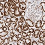 ATPIF1 Antibody in Immunohistochemistry (Paraffin) (IHC (P))