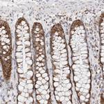 ATPIF1 Antibody in Immunohistochemistry (Paraffin) (IHC (P))