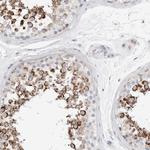 ATPIF1 Antibody in Immunohistochemistry (Paraffin) (IHC (P))