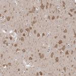 GSK3B Antibody in Immunohistochemistry (Paraffin) (IHC (P))