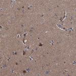 DTNBP1 Antibody in Immunohistochemistry (Paraffin) (IHC (P))