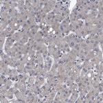 DTNBP1 Antibody in Immunohistochemistry (Paraffin) (IHC (P))