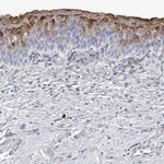 LIMK1 Antibody in Immunohistochemistry (Paraffin) (IHC (P))