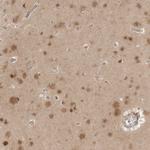 NUDC Antibody in Immunohistochemistry (Paraffin) (IHC (P))