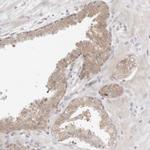 NUDC Antibody in Immunohistochemistry (Paraffin) (IHC (P))