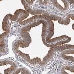 BAD Antibody in Immunohistochemistry (Paraffin) (IHC (P))