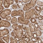 BAD Antibody in Immunohistochemistry (Paraffin) (IHC (P))