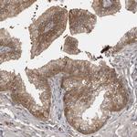 BAD Antibody in Immunohistochemistry (Paraffin) (IHC (P))