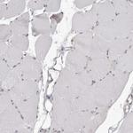 BAD Antibody in Immunohistochemistry (Paraffin) (IHC (P))