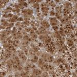 RBKS Antibody in Immunohistochemistry (Paraffin) (IHC (P))