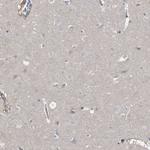 RBKS Antibody in Immunohistochemistry (Paraffin) (IHC (P))