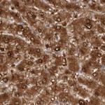 RBKS Antibody in Immunohistochemistry (Paraffin) (IHC (P))