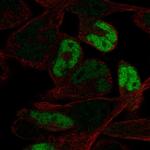 Myogenin Antibody in Immunocytochemistry (ICC/IF)