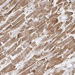 GSK3 alpha Antibody in Immunohistochemistry (Paraffin) (IHC (P))