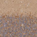 CSK Antibody in Immunohistochemistry (Paraffin) (IHC (P))