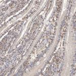 CSK Antibody in Immunohistochemistry (Paraffin) (IHC (P))