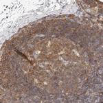 CSK Antibody in Immunohistochemistry (Paraffin) (IHC (P))