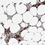 Transferrin Receptor Antibody in Immunohistochemistry (Paraffin) (IHC (P))