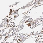 Transferrin Receptor Antibody in Immunohistochemistry (Paraffin) (IHC (P))