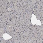 Transferrin Receptor Antibody in Immunohistochemistry (Paraffin) (IHC (P))