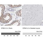 EPB41L3 Antibody