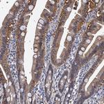 EPB41L3 Antibody in Immunohistochemistry (Paraffin) (IHC (P))