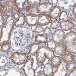 EPB41L3 Antibody in Immunohistochemistry (Paraffin) (IHC (P))