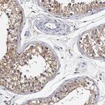 EPB41L3 Antibody in Immunohistochemistry (Paraffin) (IHC (P))