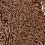 GBP5 Antibody in Immunohistochemistry (Paraffin) (IHC (P))