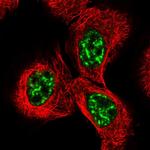 WRN Antibody in Immunocytochemistry (ICC/IF)