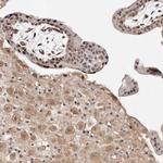 WRN Antibody in Immunohistochemistry (Paraffin) (IHC (P))