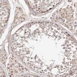 WRN Antibody in Immunohistochemistry (Paraffin) (IHC (P))