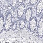 LPO Antibody in Immunohistochemistry (Paraffin) (IHC (P))