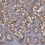 INPP5B Antibody in Immunohistochemistry (Paraffin) (IHC (P))